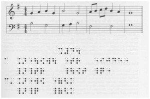 BME (Braille Music Editor) Es un editor musical para personas ciegas o con baja visión. Reconoce partituras musicales en formato Braille computerizado. Permite una reproducción musical perfecta a través de una tarjeta de sonido PC. Permite pasar lo escrito en Braille (con el teclado convencional) a sistemas compatibles con el mercado estándar. Permite importar ficheros escritos en procesadores comerciales.